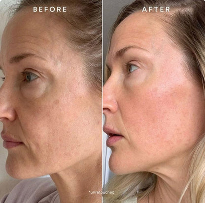 Viral bio-collagen korean face mask for instant glow